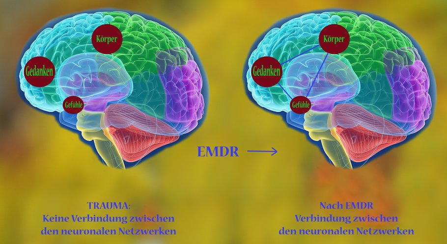 EMDR